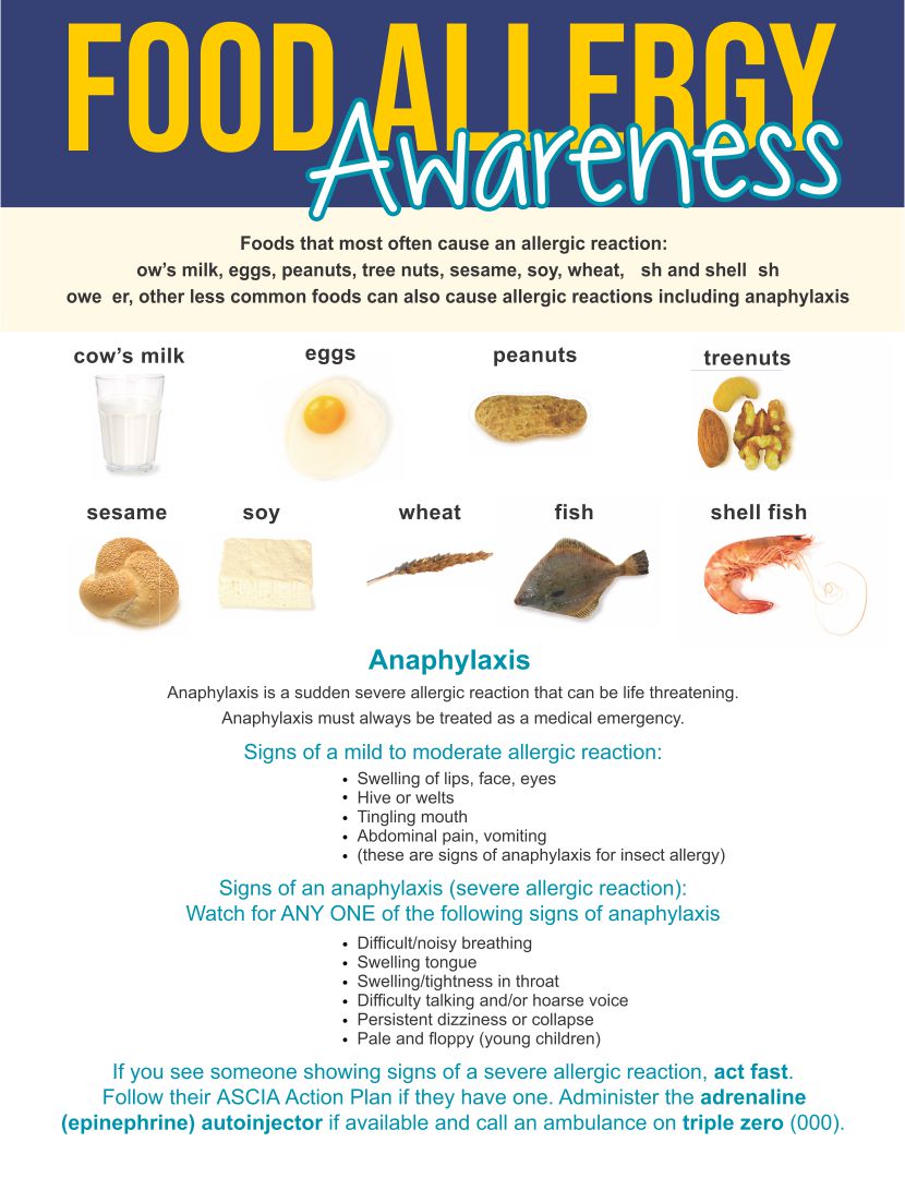 printable-food-allergies-poster-my-xxx-hot-girl