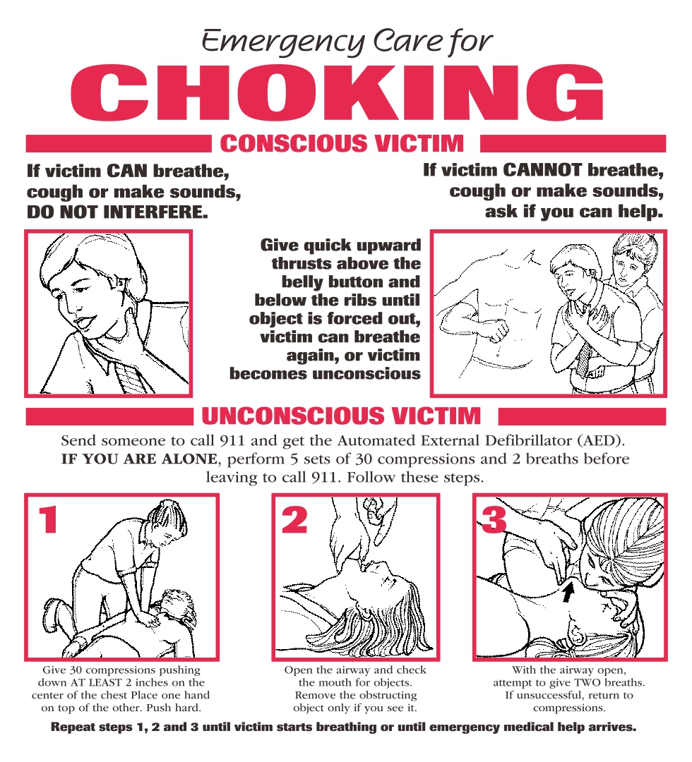 American Heart Association Printable Choking Poster Free