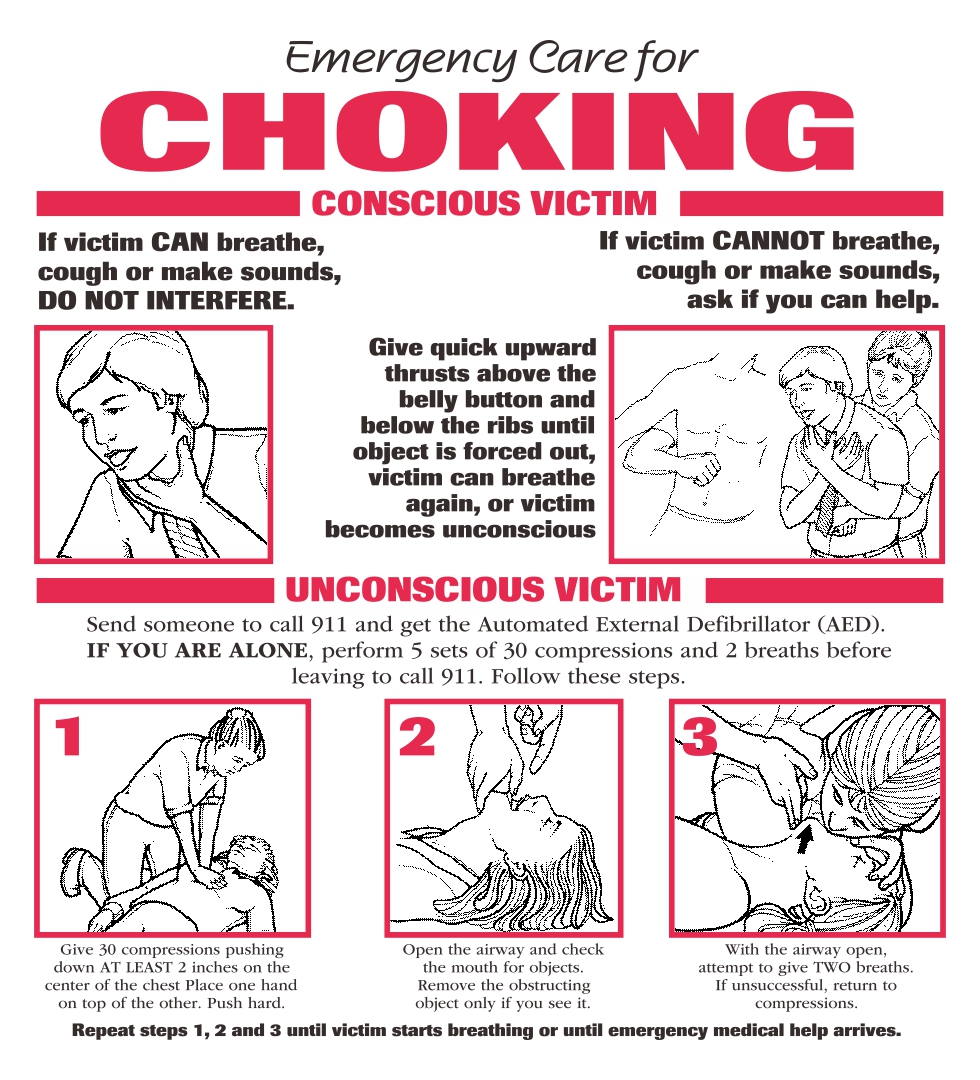 10-best-first-aid-choking-poster-printable-pdf-for-free-at-printablee