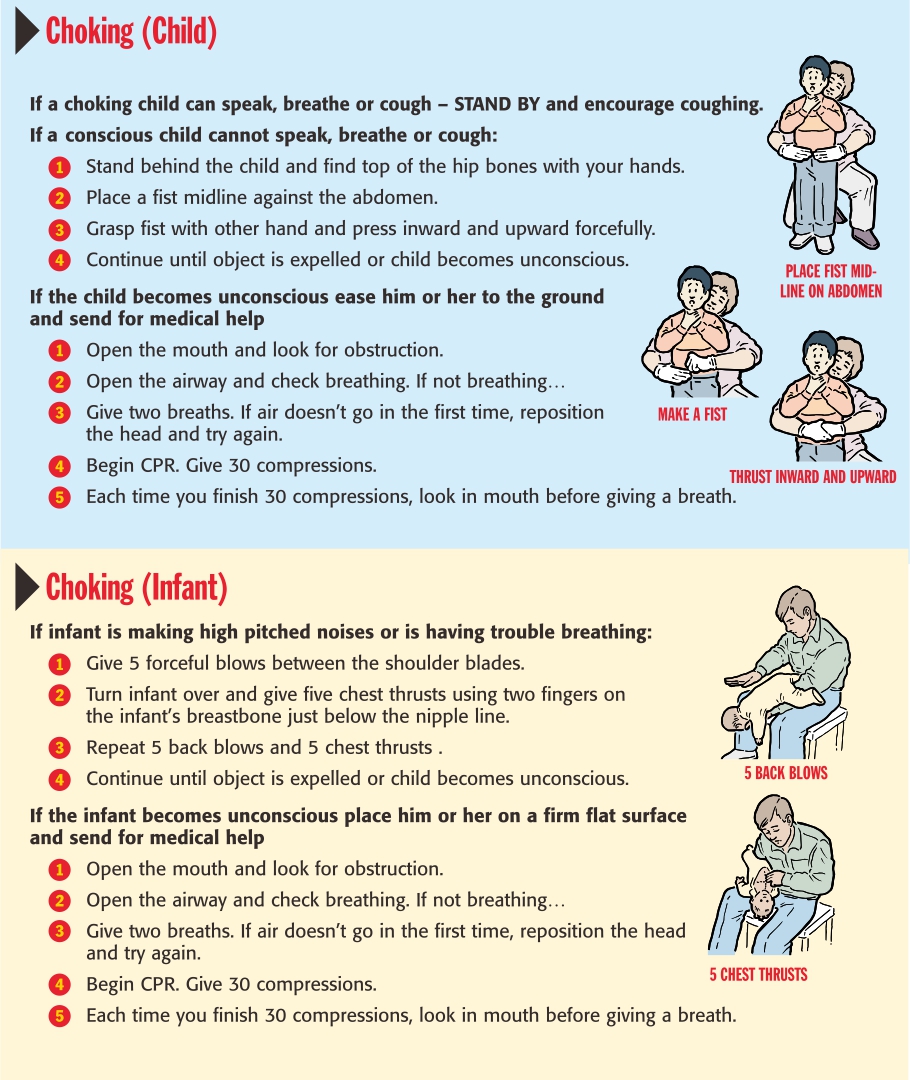 First Aid for Choking Infant and Child